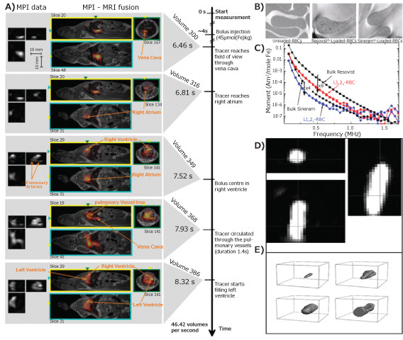 MPI, MPI-MRI and TEM images MPI, MPI-MRI and TEM images