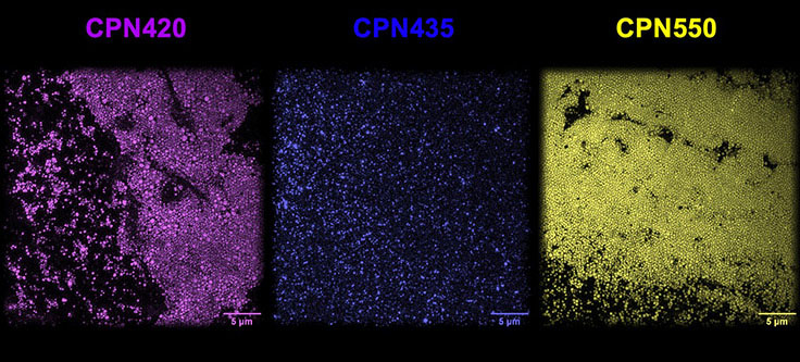 超解像顕微鏡で撮影されたCPN