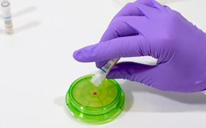 Growth Promotion test for Milliflex OASIS<sup>®</sup> system with Vitroids™ and LENTICULE<sup>®</sup> discs Placing a Vitroids disc on a Milliflex Oasis plate during a growth promotion test in a microbiology lab