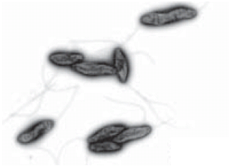 Electron microscope image of Campylobacters Electron microscope image of Campylobacters