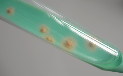 Mycobacteria Colonies On TB-Medium Mycobacteria colonies on TB-Medium