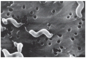 Scanning electron micrograph Scanning electron micrograph