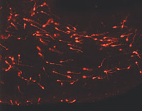 PKH26-Labeled Young Migrating Neurons PKH26で標識された遊走性の幼若ニューロン