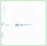 Western Blotting and Immunohistochemistry