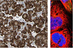 ihc-staining-of-human-pancreas-tissue