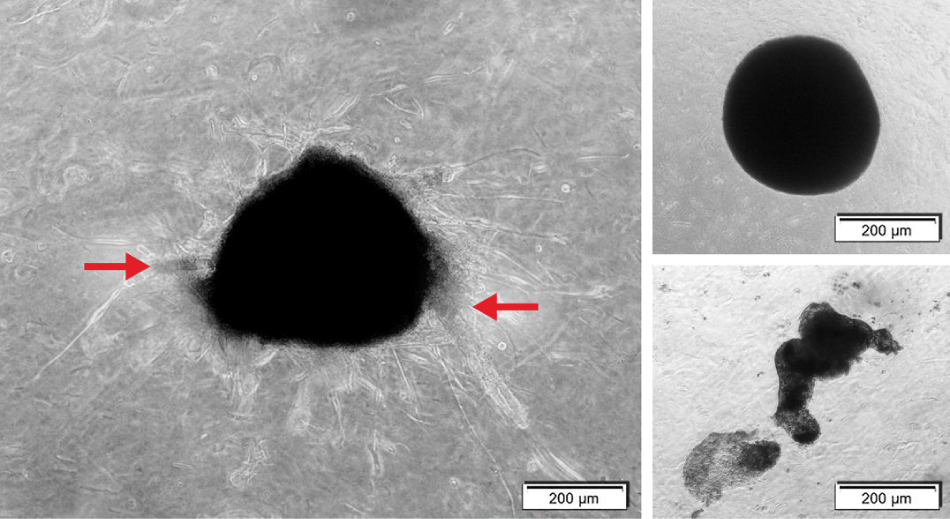 Organoids in collagen gels In images A and B, a completely filled in circle covers the center of the image, representing the organoid. In image C, two irregular ovals are at the center of the image, representing the organoid.