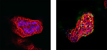 H. pylori infection of apical-out gastric organoids