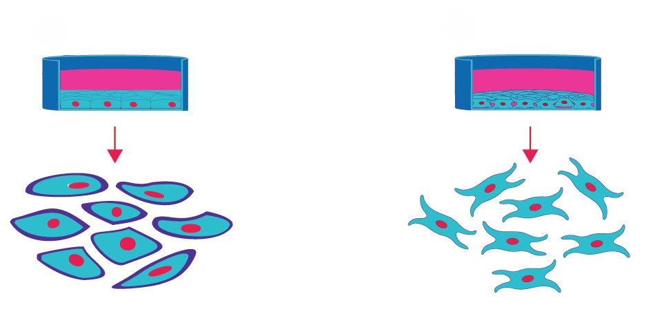 Cartoon representation of MCF-7 and fibroblasts in 2D cell culture. Cartoon representation of MCF-7 and fibroblasts in 2D cell culture.