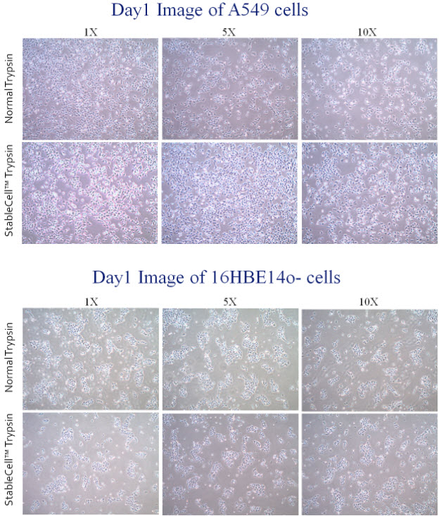 StableCell™ Trypsin vs Normal Trypsin StableCell™ Trypsin vs Normal Trypsin