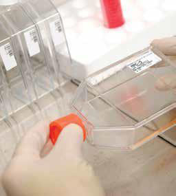 Scientist performing the subculture of an adherent cell monolayer in a laboratory setting.