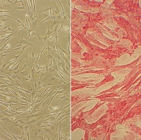 Human Pulmonary Artery Smooth Muscle Cells (HPASMC) Culture Protocol Human Pulmonary Artery Smooth Muscle Cells (HPASMC)