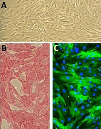 Human Aortic Smooth Muscle Cells (HAOSMC) Human Aortic Smooth Muscle Cells (HAOSMC)