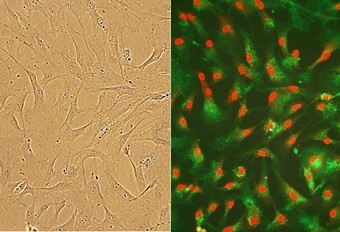 Human Cardiac Fibroblasts 人心脏成纤维细胞