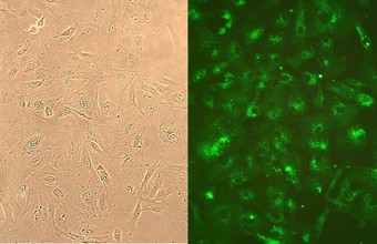 human-lung-fibroblasts Human Lung Fibroblasts