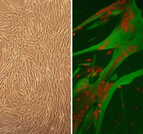 Human Skeletal Muscle Cells (HSkMC) Human Skeletal Muscle Cells (HSkMC)