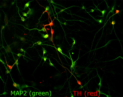 Small ovals indicating the cell body of the neurons cluster in the center of the image, connected by thin lines.