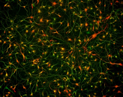 Cortical GABAergic neurons Small ovals, indicating the cell body of the GABAergic neurons, are scattered across the entire image. Each oval has two lines coming off it on opposite sides, connecting the neurons to each other.