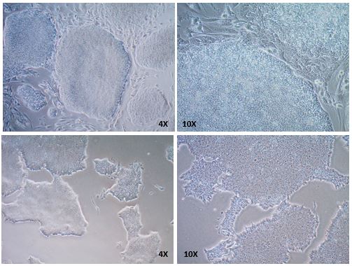 EZ-LiFT™ reagent removes feeders from human iPSC cocultures. EZ-LiFT™ reagent removes feeders from human iPSC cocultures.