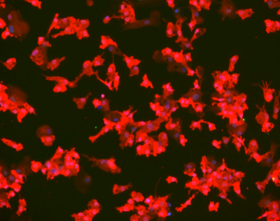 Immunofluorescent image of microglia