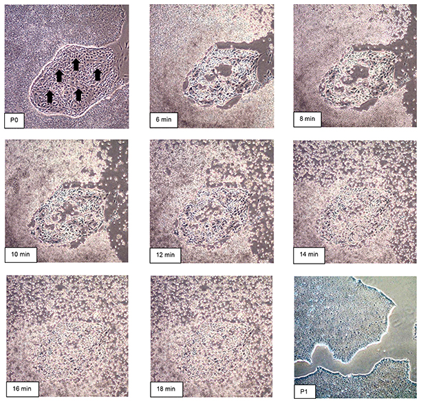 Time course of human iPS cell passaging using EZ-LiFT™ reagent. Time course of human iPS cell passaging using EZ-LiFT™ reagent.