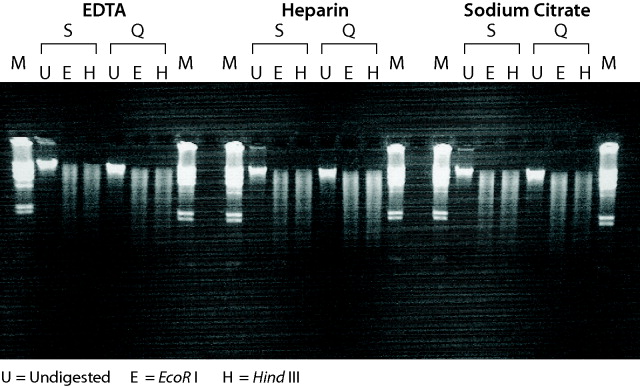 Genomic DNA purified by GenElute™ Blood Genomic DNA kits is suitable for restriction enzyme digestions Genomic DNA purified by GenElute™ Blood Genomic DNA kits is suitable for restriction enzyme digestions.