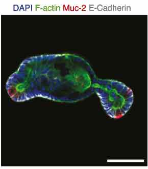 Protein expression of mucin-2 Protein expression of mucin-2