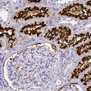 Immunohistochemical staining of human kidney tissue sections Immunohistochemical staining of human kidney tissue sections