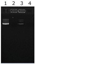 DNA修飾蛍光SiO2ナノ粒子の電気泳動パターン DNA修飾蛍光SiO2ナノ粒子の電気泳動パターン