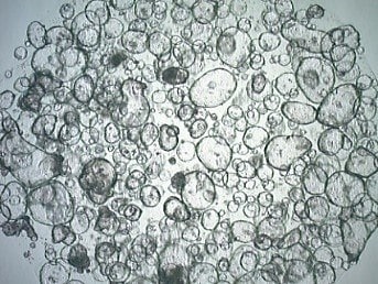 Matrigel dome organoid Matrigel dome organoid