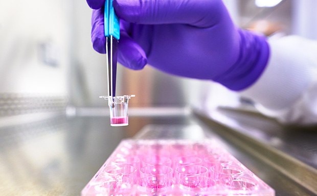 cell culture inserts cell culture inserts