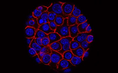 Flourescent cell cluster Flourescent cell cluster