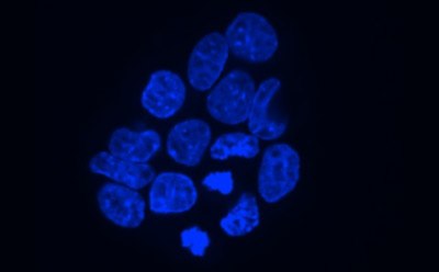 Flourescent image of cells Flourescent image of cells