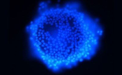 Stained cells Stained cells