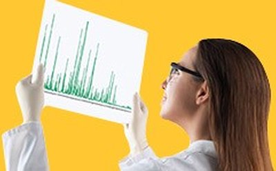 400px HPLC Chromatogram Científica viendo un cromatograma de HPLC