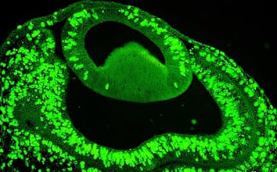 Proliferating cells in the eye of E4 chick embryo using BrdU staining Proliferating cells in the eye of E4 chick embryo using BrdU staining