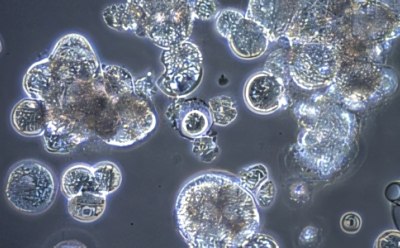 Cell clumping in culture Cell clumping in culture
