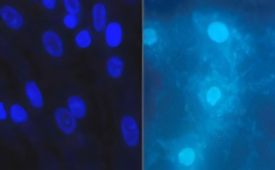 Cell culture contamination Cell culture contamination