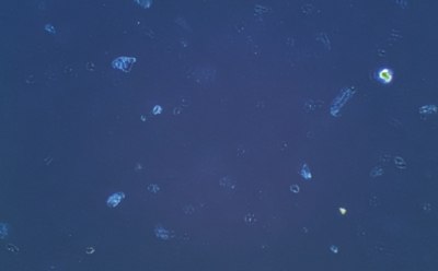 Cell culture precipitates Cell culture precipitates