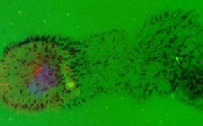 Imagen de microscopia de fluorescencia que muestra un análisis celular con expresión de proteína fluorescente verde, indicativa de procesos celulares activos, junto con puntos concentrados de fluorescencia roja y amarilla que resaltan marcadores específicos o áreas de interés dentro de las células. Imagen de microscopia de fluorescencia que muestra un análisis celular con expresión de proteína fluorescente verde, indicativa de procesos celulares activos, junto con puntos concentrados de fluorescencia roja y amarilla que resaltan marcadores específicos o áreas de interés dentro de las células.
