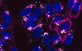 Imagen microscópica que muestra múltiples células con núcleos de color azul claro rodeados por una red de estructuras rosas, sobre un fondo oscuro, destacando los intrincados detalles de los componentes celulares. Imagen microscópica que muestra múltiples células con núcleos de color azul claro rodeados por una red de estructuras rosas, sobre un fondo oscuro, destacando los intrincados detalles de los componentes celulares.