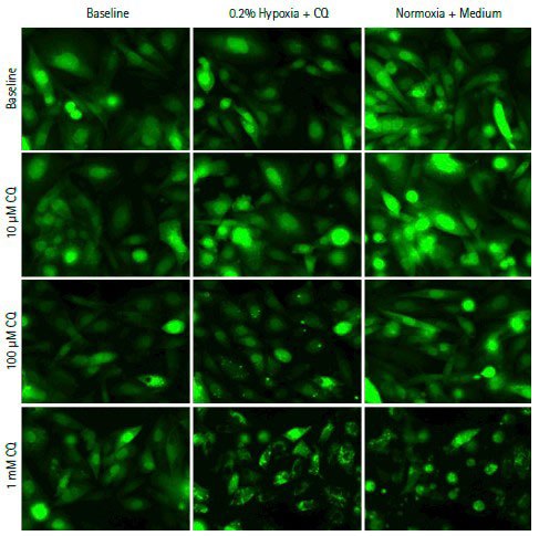 Cells cultured on the CellASIC™ ONIX microfluidic live cell imaging system Live cell imaging in hypoxia-induced autophagy assay using the CellASIC® system