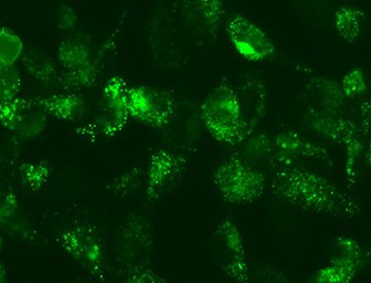 LentiBrite LC3 Lentiviral Particle autophagy assay Fluorescent lentiviral particle cellular assay assesses autophagy