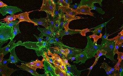 Mesenchymal stem cells Stem Cell Culture