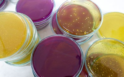 Microbial cell culture Bacterial cell culture on agar plates