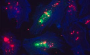 Células transfectadas para estudios de expresión de proteínas y función génica Células transfectadas para estudios de expresión de proteínas y función génica