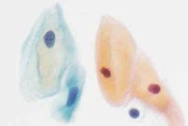 Papanicolaou’s staining – Harris Hematoxylin Diagnostic cytologic staining of Pap smear sample