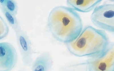 Gynecological smears Tinción citológica para diagnóstico de frotis de Pap