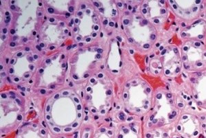 Histolog&iacute;a
