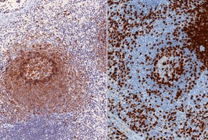 Inmunohistoqu&iacute;mica