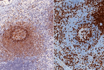 Inmunohistoqu&iacute;mica